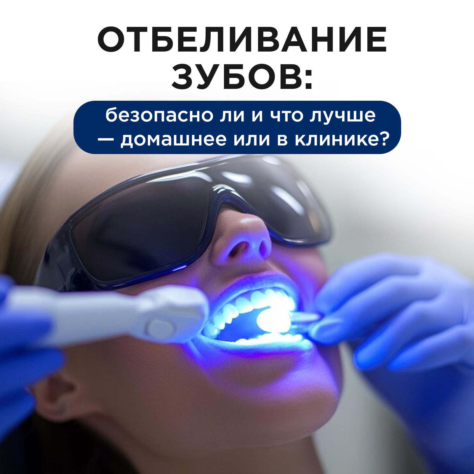 Отбеливание зубов: безопасно ли и что лучше &mdash; домашнее или в клинике?